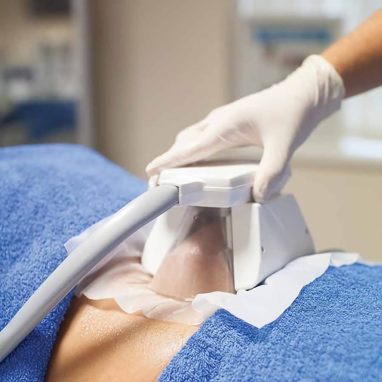 Amincissement par Cryolipolyse - Supremacy and Perfect